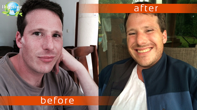 Slider image (6) Ibogaine by David Dardashti